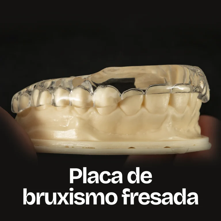 placa de bruxismo_3