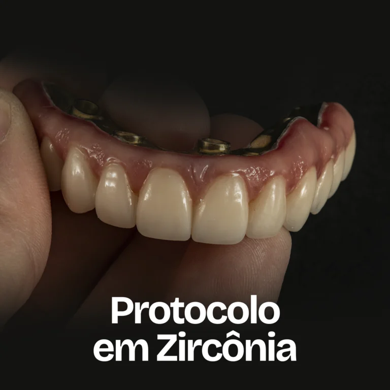 protocolo em zircônia_3